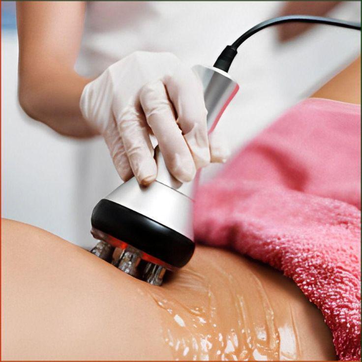 Lipocavitation & Radiofréquence